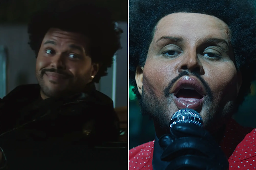 the weeknd plastic surgery